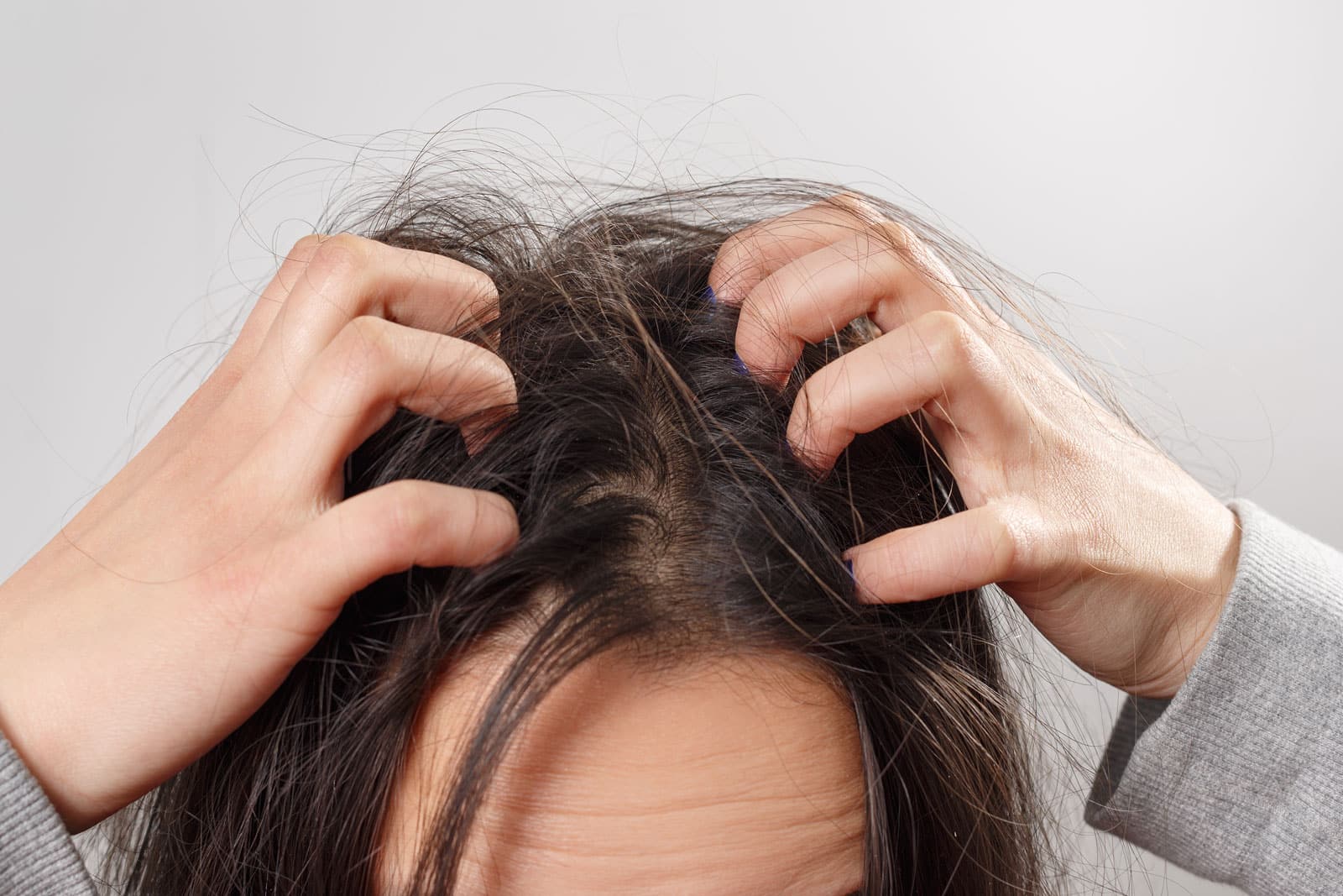 Understanding Sensitive Scalp: Causes, Treatments, and Care Tips - Katharē Hair Care